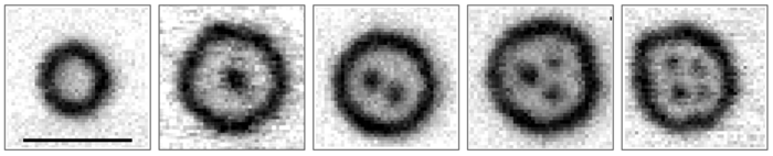 Graphic white and black of X-ray images